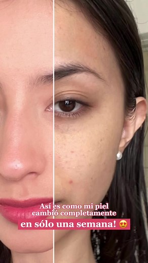 Mejora tu piel con Blends Botanicare en una semana