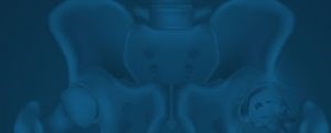 Periacetabular Osteotomy (PAO) | David Slattery
