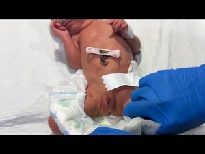 Female Baby Diaper Change #newborn #baby