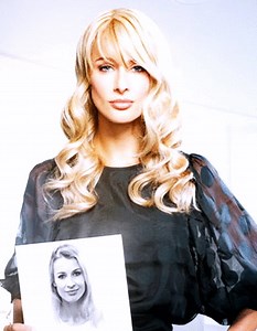 Prothèse Capillaire, Top Qualité, Vaste Sélection à La Clinique Capillaire