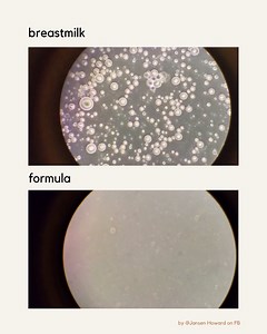 We all know the benefits of breastfeeding. Even knowing them, this video absolutely blew my mind; breastmilk under a microscope compared to formula under a microscope. This came about from a mama named Jansen Howard, who wanted to see for herself what the difference between formula and breastmilk was when her bub was unwell. Her papa-bear was a microscopist, and with his help, they put a single drop of breastmilk under the microscope and discovered that her breastmilk came to life. The bubble-sh