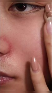 😮This lightweight makeup primer from otwo brightens skin and covers blemishes. Creates a natural finish that makes your makeup look more natural and fresh.😍😍 | OTWOObeauty-PH