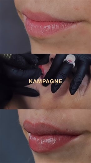 Klinik AURA on Instagram: "✨ Permanent Makeup – Læber Op til 3 behandlinger for prisen af 2 Drømmer du om smukkere, mere ensartede læber – uden at det ser kunstigt ud? For første gang tilbyder jeg et særligt PMU-læbeforløb med ekstra inkluderet. Kampagnen gælder ved booking af konsultation, der finder sted senest 28. februar. Behandlingerne kan planlægges senere, når det passer dig. Forløbet inkluderer: • Gratis og uforpligtende konsultation • 2 behandlinger • Mulighed for 3. behandling uden eks