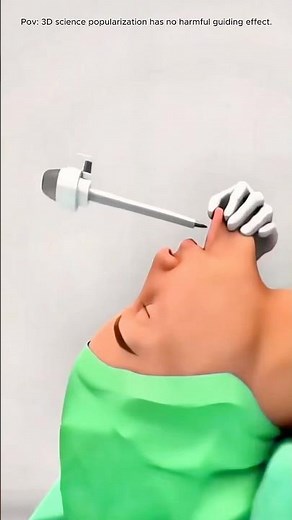 Thyroidectomy Surgery (3D Animation)#thyroid#surgery#neck#anesthesia#3danimation