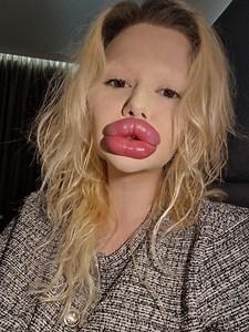 Andrea Ivanova Earns Herself The World’s Largest Lips After Spending Over $26k On Lip Filler - BlackSportsOnline