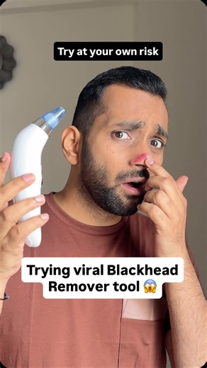 Ankit Gupta | ANKIT TV on Instagram: "Comment FACE to get links 🔗 Tried the viral blackhead remover tool so you don’t have to 😳 Satisfying or scam? The way this pulled out gunk from my nose was lowkey shocking… but is it actually safe for your skin? Watch till the end before you try this at home 👀 #SkincareForMen #BlackheadRemoval #ViralBeautyHack #GroomingEssentials #MensSkincare Keywords: viral blackhead remover tool, blackhead remover review, pore cleaning tool, men skincare routine, nose 