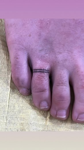 Toe Ring Tattoo Designs for Minimalist Aesthetics
