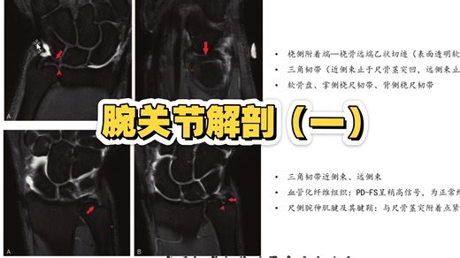 腕关节解剖（一）:三角纤维软骨复合体TFCC，速来学习吧~