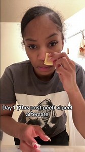 Chemical peel journey: vi peel purify precision plus #skincare