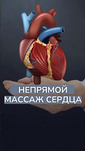 Непрямой массаж сердца
