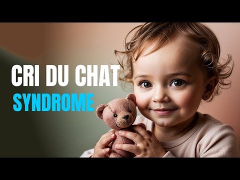 What is Cri Du Chat Syndrome Cry
