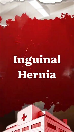 Inguinal Hernia: Symptoms, Causes & Who Is at Risk?