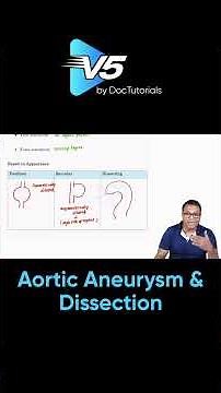 Abdominal Aortic Aneurysm & Dissection| High Risk,Rupture, Diagnosis & Classification | DocTutorials