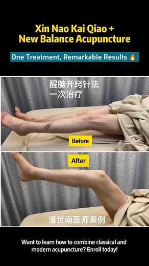 10K views · 94 reactions | Today’s treatment combination:  Awakening...