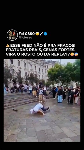 Foi OSSO 🤕🦴 on Instagram: "CLIQUE EM SEGUIR 👆 👆 👆 🦴 Sabia que? Ossos quebrados demoram de 6 a 12 semanas para cicatrizar O tempo de cicatrização depende do tipo de fratura, da idade e da saúde geral da pessoa. Crianças geralmente se recuperam mais rápido que adultos. Durante esse período, o osso passa por três fases: inflamação, formação de calo ósseo e remodelação. É importante seguir orientações médicas, evitar esforço excessivo e ter alimentação rica em cálcio e vitamina D para ajudar n