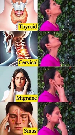 Simple Yoga Practices for Better Health | Neck Relaxation, Breathing & Natural Healing