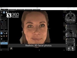 Carestream CS Face Scan