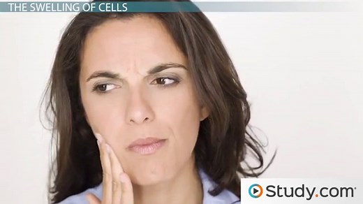 Hydropic Degeneration Causes & Significance | What Causes a Cell to Swell?