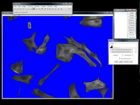 How to take area measurements of cells using ImageJ