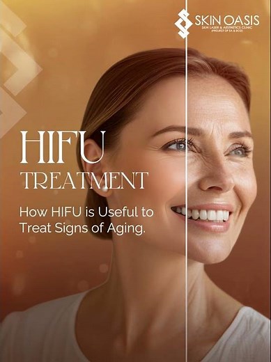 HIFU Treatment | Real Results Before & After