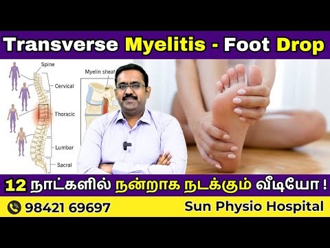 Transverse Myelitis Foot Drop Treatment in Tamil | Exercises & Walking Improvement | Sun Physio