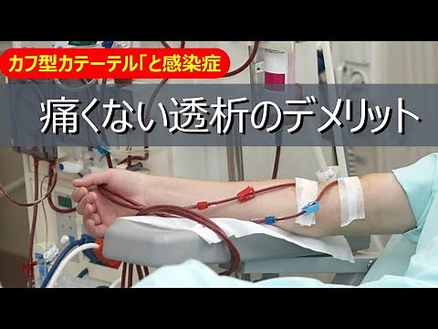 【血液透析】針を刺さないから痛くない カフ型カテーテル透析のメリットと感染症になるリスクが付きまとうデメリット