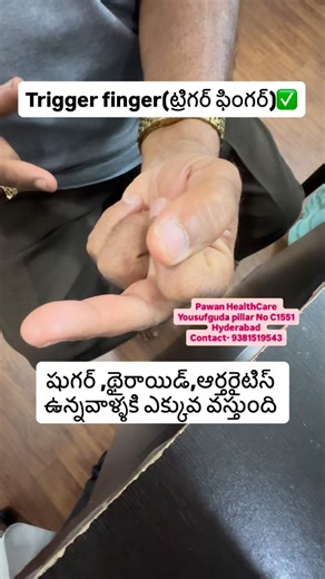 PawanHealthCare on Instagram: "Unable to bend the middle finger can happen due to several conditions. The most common possibilities depend on pain, swelling, locking, numbness, or history of injury. Most commonly trigger finger. Other causes include tendon injury, arthritis, or nerve issues. Sudden loss after injury needs urgent evaluation #clinic #hospital"
