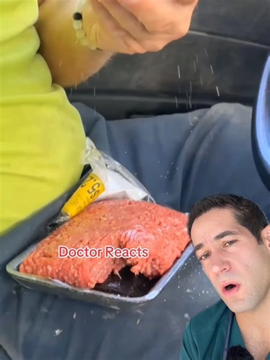 Understanding Raw Ground Beef vs Rare Steak