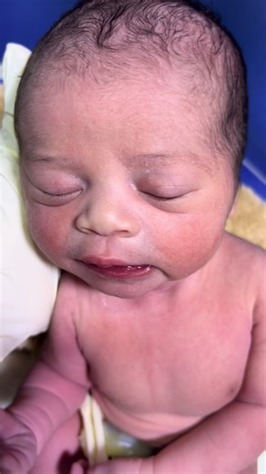 Understanding the Moro Reflex in Infants