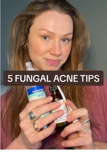 5 New Tips for Fungal Acne Treatment