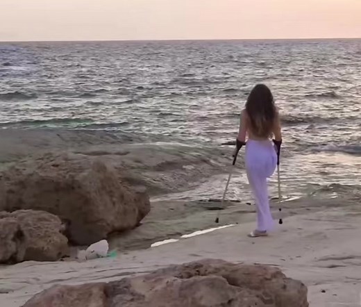 Inspirational Amputee Stories and Modeling Journey