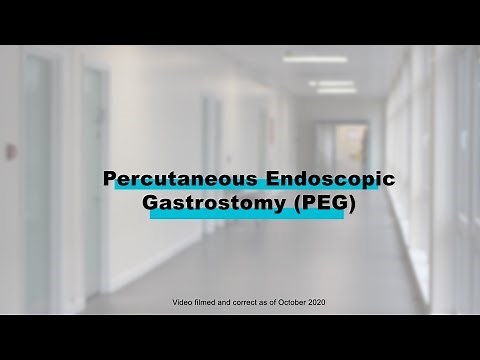 Endoscopy Procedures | Percutaneous Endoscopic Gastrostomy (PEG)