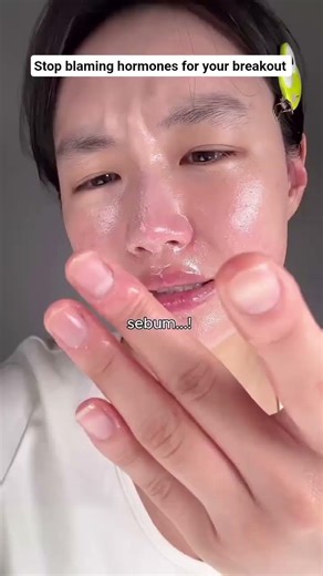 You may be using the wrong skin care product #skincare #comedones #glowingskin #shorts #acne