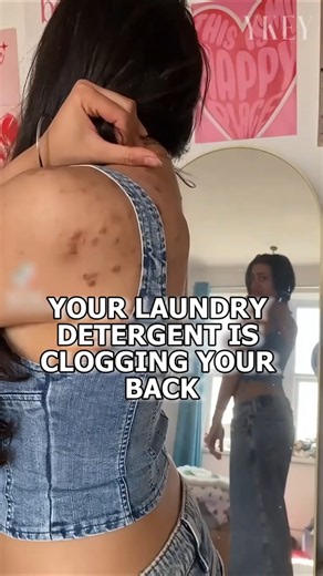 Your Laundry Detergent Is Clogging Your Back