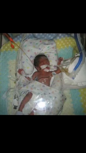 Many of you may not know the strength I've had to find as a mother of a child born at 25 weeks gestation. The first 7 years of Javi Jr's life were spent in and out of hospitals, with doctors telling me he'd never make it. But he proved them wrong, and I'm still fighting for him 13 years later. There were times when the hospital staff asked me to consider taking him off life support, but I knew God had bigger plans. I cried out to Him, begging Him not to take my son from me. Javi Jr is a miracle,