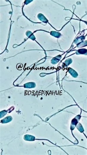 При долгом воздержании сперматозоиды «стареют»: • падает их подвижность • увеличивается доля повреждённой ДНК В итоге сперма есть, а эффективность ниже.