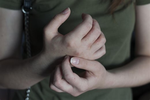 Ten objaw na skórze wielu myli z alergią. Tymczasem może sygnalizować poważne problemy psychiczne