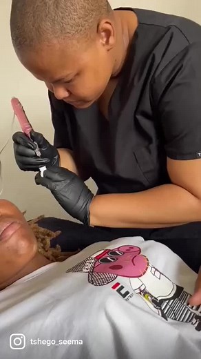 TANGO Procedure: A Step-by-Step Guide to Treatment