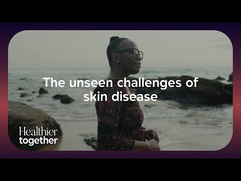 The unseen challenges of skin disease | Recognising the impact of skin health