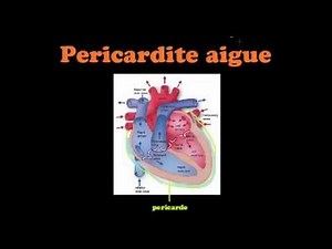 SmartN'Easy Cardio - Pericardite Aigue - Dr Astuce