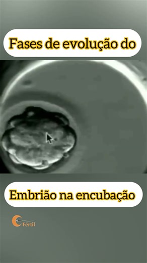 #fertilizaçãoinvitro