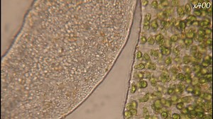 Jeune ver de Roscoff comparé à un adulte au microscope