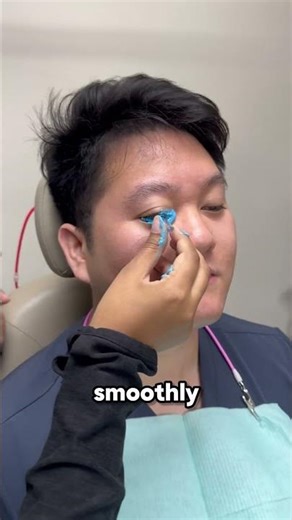 How Doctors Create Perfectly Fitted Contact Lenses