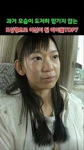 TOP 7 Idols Who Became Goddesses After K-Plastic Surgery: You Won't Believe Their Past Looks