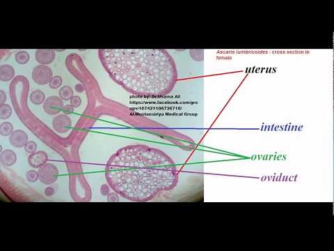 Ascaris lumbricoides male and female cross section with details