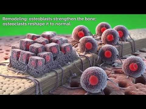How Bones Break and Heal: Real 3D Anatomy Explained Step-by-Step