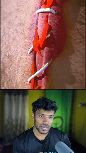 How Stitches Heal Wounds 🪡