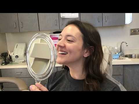 Gum Contouring, Teeth Reshaping, and Bonding by Cleveland's Dr. Marsh!