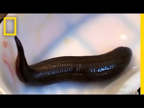 Leeches Cure | National Geographic