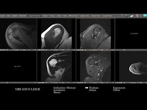 [MRI] Shoulder | Search Pattern